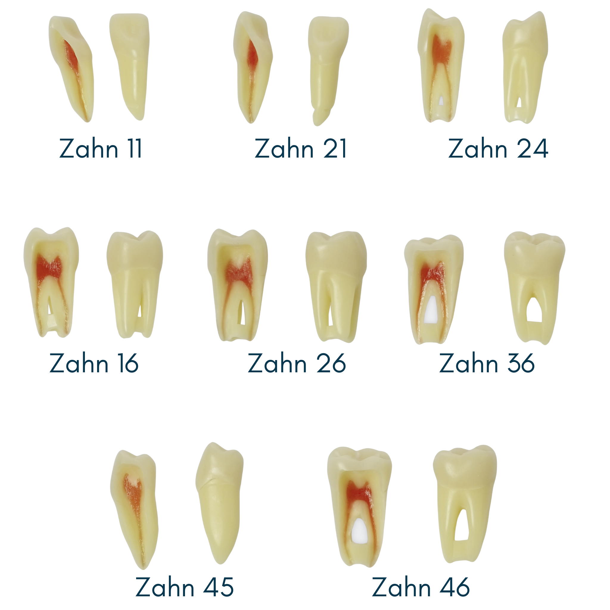 Endodontie-Zähne mit anatomischen Wurzeln <br> Z3RN