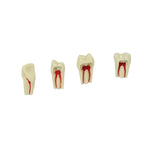 Endodontie-Zähne mit elfenbeinfarbigen Wurzeln <br> ZPUR