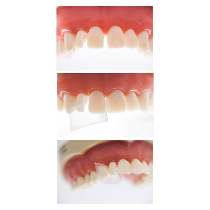 ProxyPal <br> Lichtmatrizen | gebogen