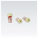 Endodontie-Zähne mit transparenten Wurzeln <br> ZPUKN | ANA-4