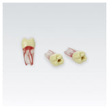 Endodontie-Zähne mit transparenten Wurzeln <br> ZPUKN | ANA-4