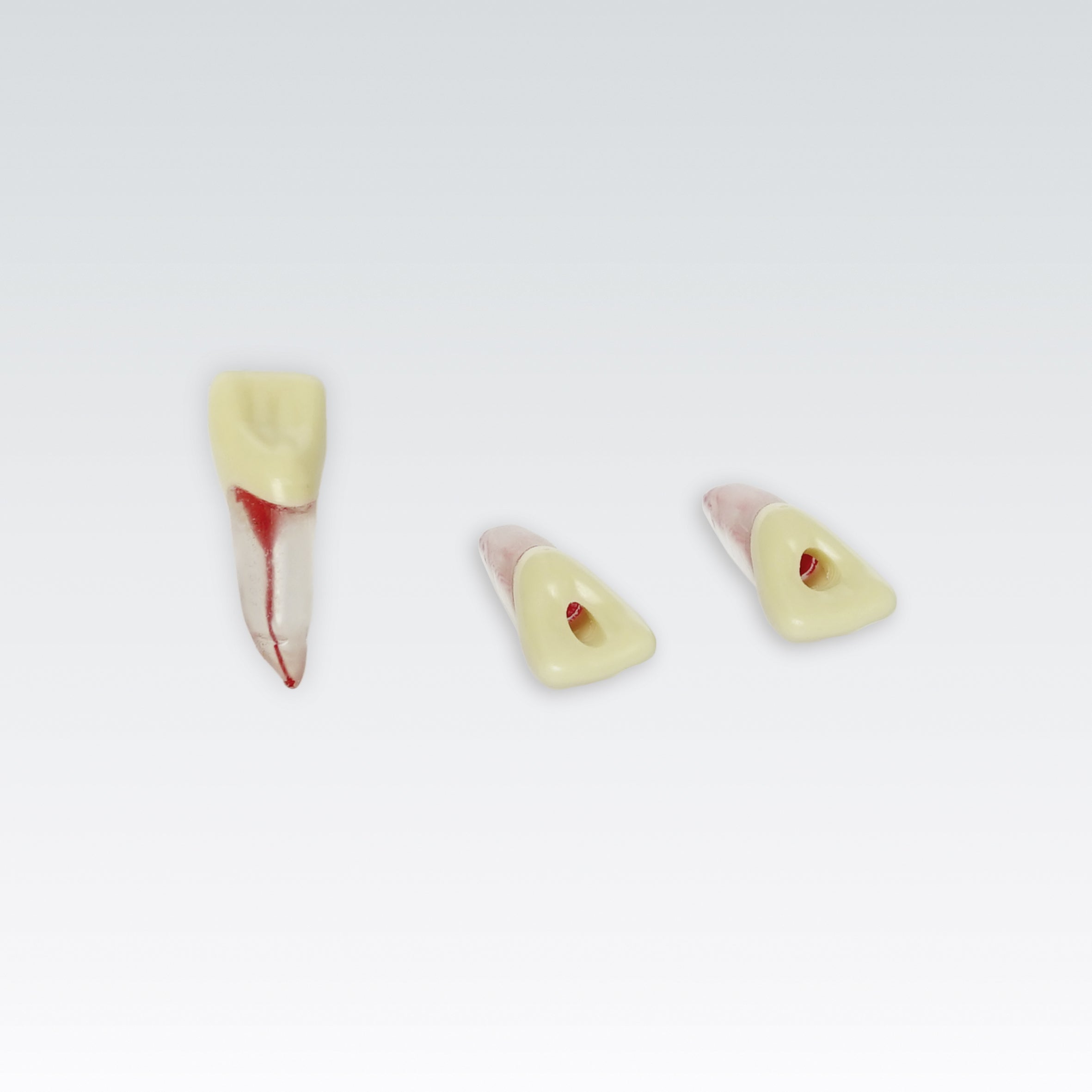 Endodontie-Zähne mit transparenten Wurzeln <br> ZPUKN | ANA-4