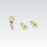 Endodontie-Zähne mit transparenten Wurzeln <br> ZPUKN | ANA-4
