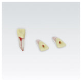 Endodontie-Zähne mit transparenten Wurzeln <br> ZPUKN | ANA-4
