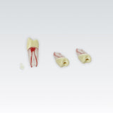 Endodontie-Zähne mit transparenten Wurzeln <br> ZPUKN | ANA-4