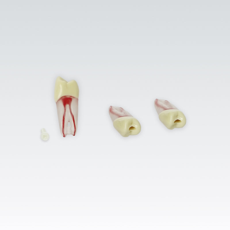 Endodontie-Zähne mit transparenten Wurzeln <br> ZPUKN | ANA-4