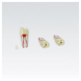 Endodontie-Zähne mit transparenten Wurzeln <br> ZPUKN | ANA-4