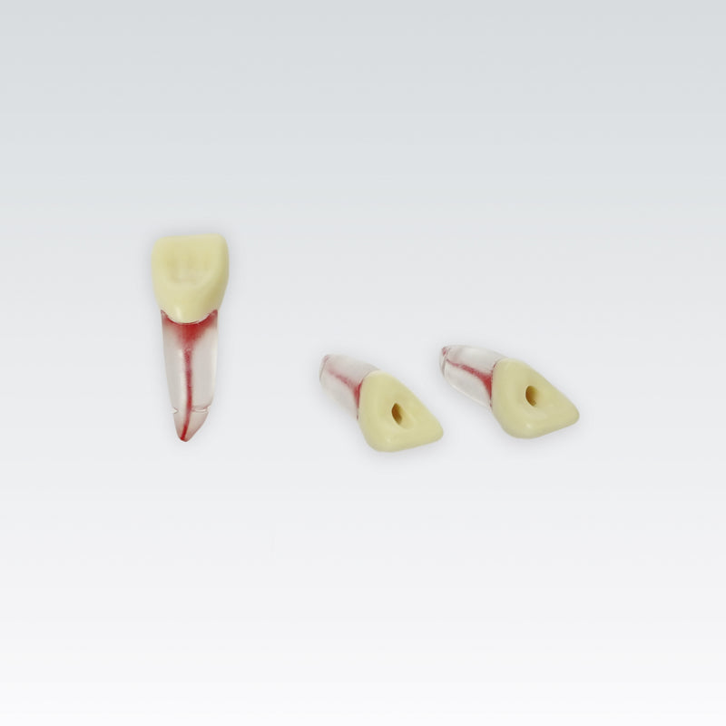 Endodontie-Zähne mit transparenten Wurzeln <br> ZPUKN | ANA-4