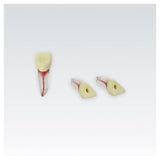 Endodontie-Zähne mit transparenten Wurzeln <br> ZPUKN | ANA-4