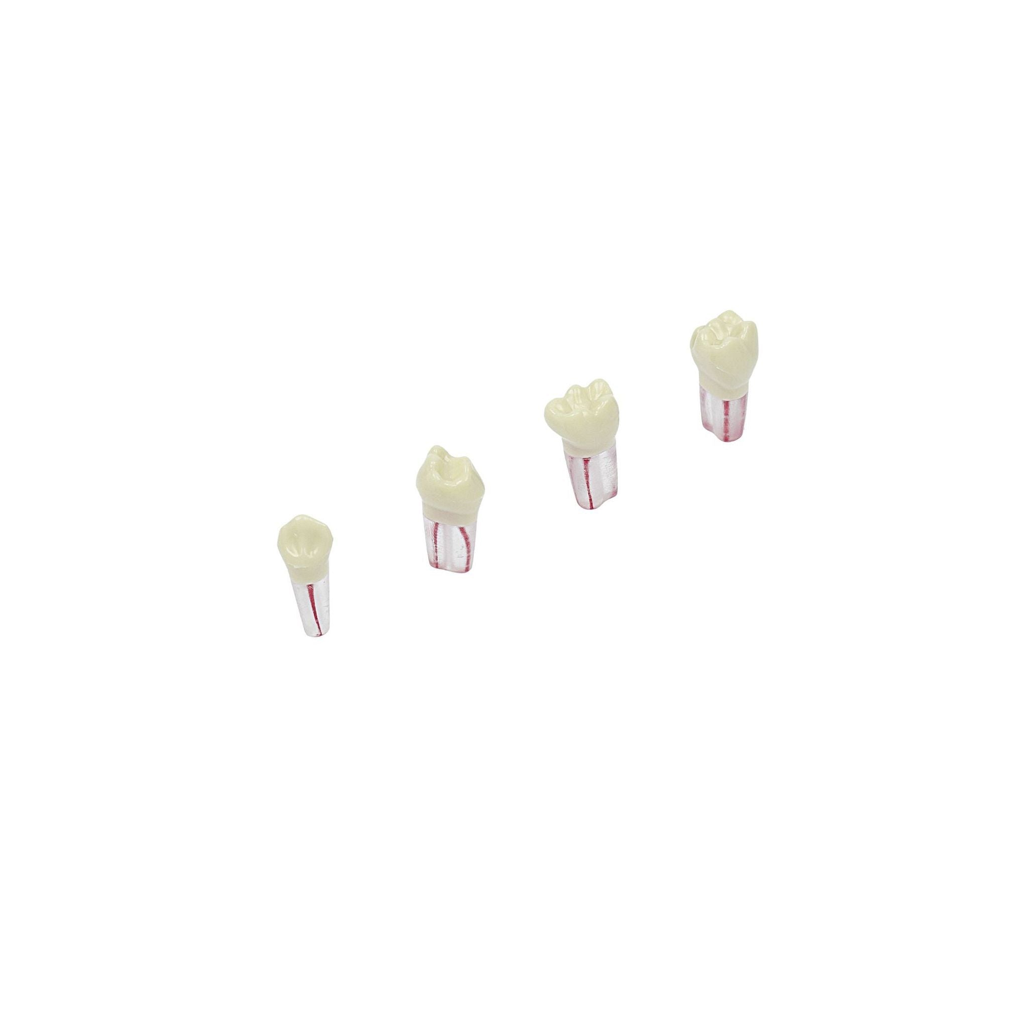 Milchzähne <br> Endodontie <br> AK-6/2 & AK-6 ZPUF