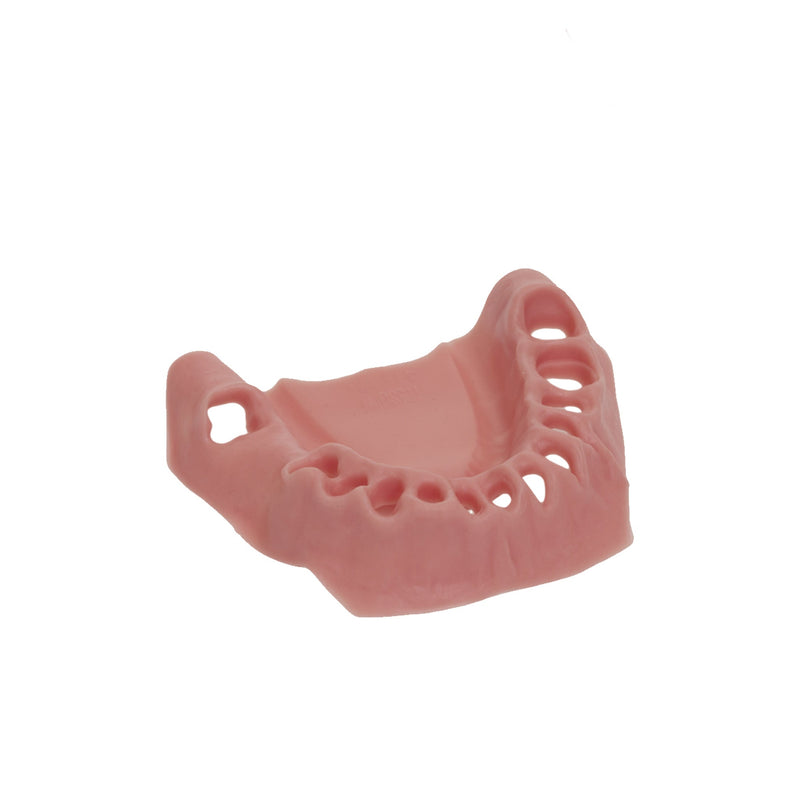 Gingival masks