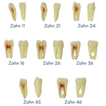 Endodontie-Zähne mit anatomischen Wurzeln <br> Z3RN