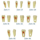 Endodontic teeth with anatomical roots<br> Z3RN