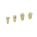Zweischicht-Zähne mit Karies <br> ZSDK 301 V1 | Frasaco