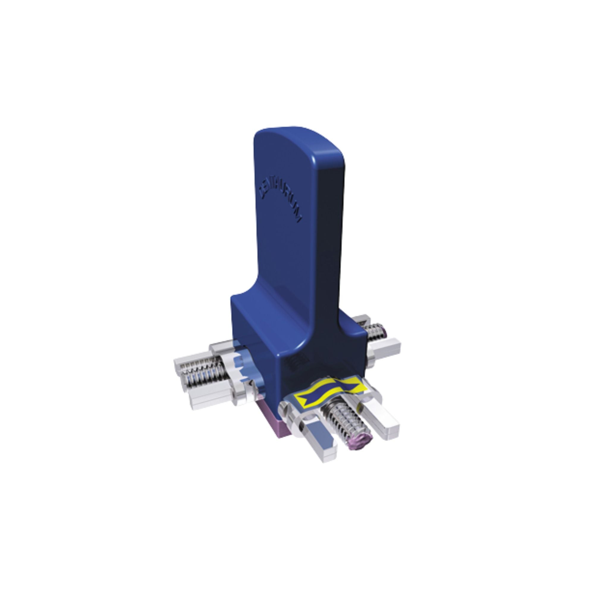 Mehrsektorenschraube nach Bertoni <br> zwei Sektionsbereiche (Typ B)