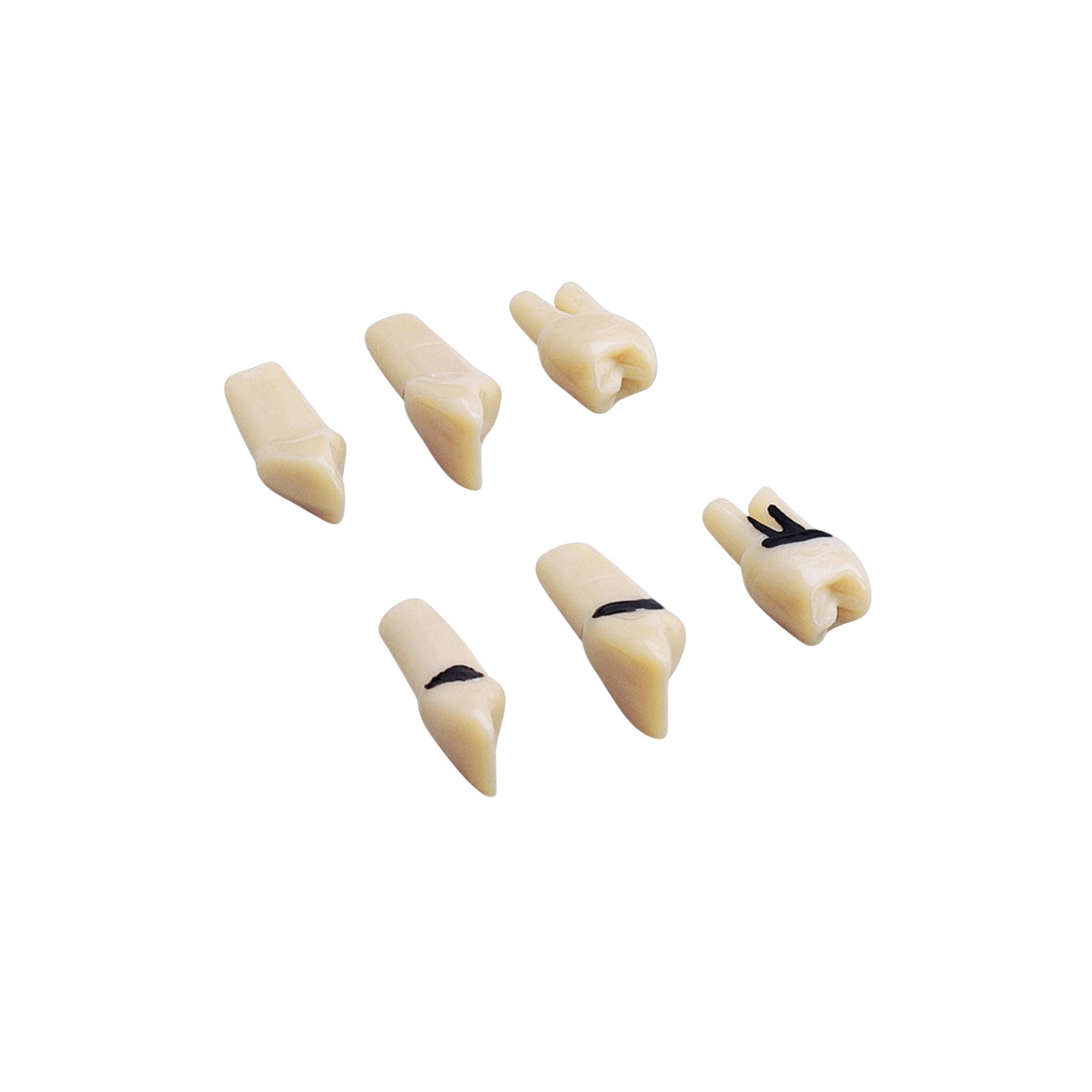 Parodontologie-Zähne <br> A-PZ ZEC | mit Calculus