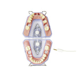 Röntgen- und Endometriemodell <br> A-REE UK/OK 903