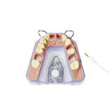 Röntgen- und Endometriemodell <br> A-REE UK/OK 903