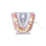 Röntgen- und Endometriemodell <br> A-REE UK/OK 903