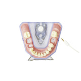 Röntgen- und Endometriemodell <br> A-REE UK/OK 903