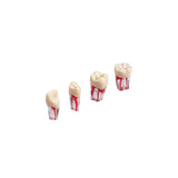 Endodontie-Zähne mit transparenten Wurzeln <br> ZPUK 300