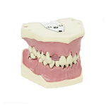 Zahnmodelle Parodontologie <br> A-PB | A-PB OC | A-PZ
