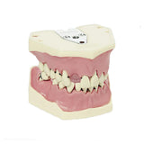 Zahnmodelle Parodontologie <br> A-PB | A-PB OC | A-PZ