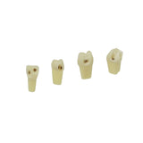Zweischicht-Zähne mit Karies <br> ZSDK 301 V1 | Frasaco