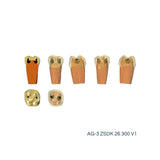 Zweischicht-Zähne mit Karies <br> ZSDK 300 V1 | Frasaco