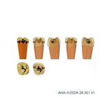 Zweischicht-Zähne mit Karies <br> ZSDK 301 V1 | Frasaco
