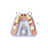 X-ray and endometry model<br> A-REE UK/OK 903