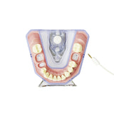 X-ray and endometry model<br> A-REE UK/OK 903