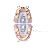 X-ray and endometry model<br> A-REE UK/OK 903