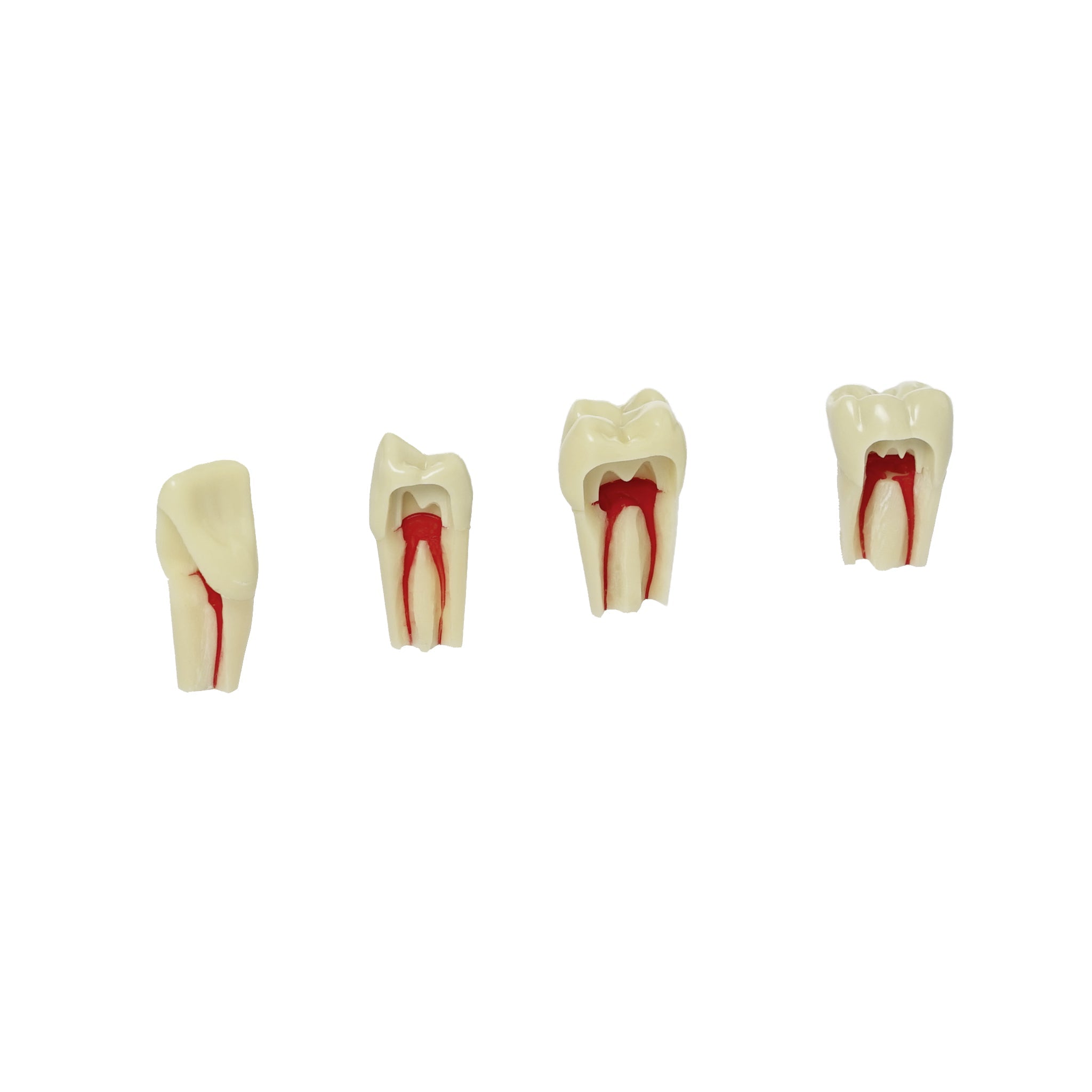 Endodontie-Zähne mit elfenbeinfarbigen Wurzeln <br> ZPUR