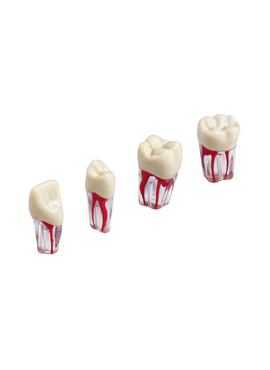Endodontie-Zähne mit transparenten Wurzeln <br> ZPUK