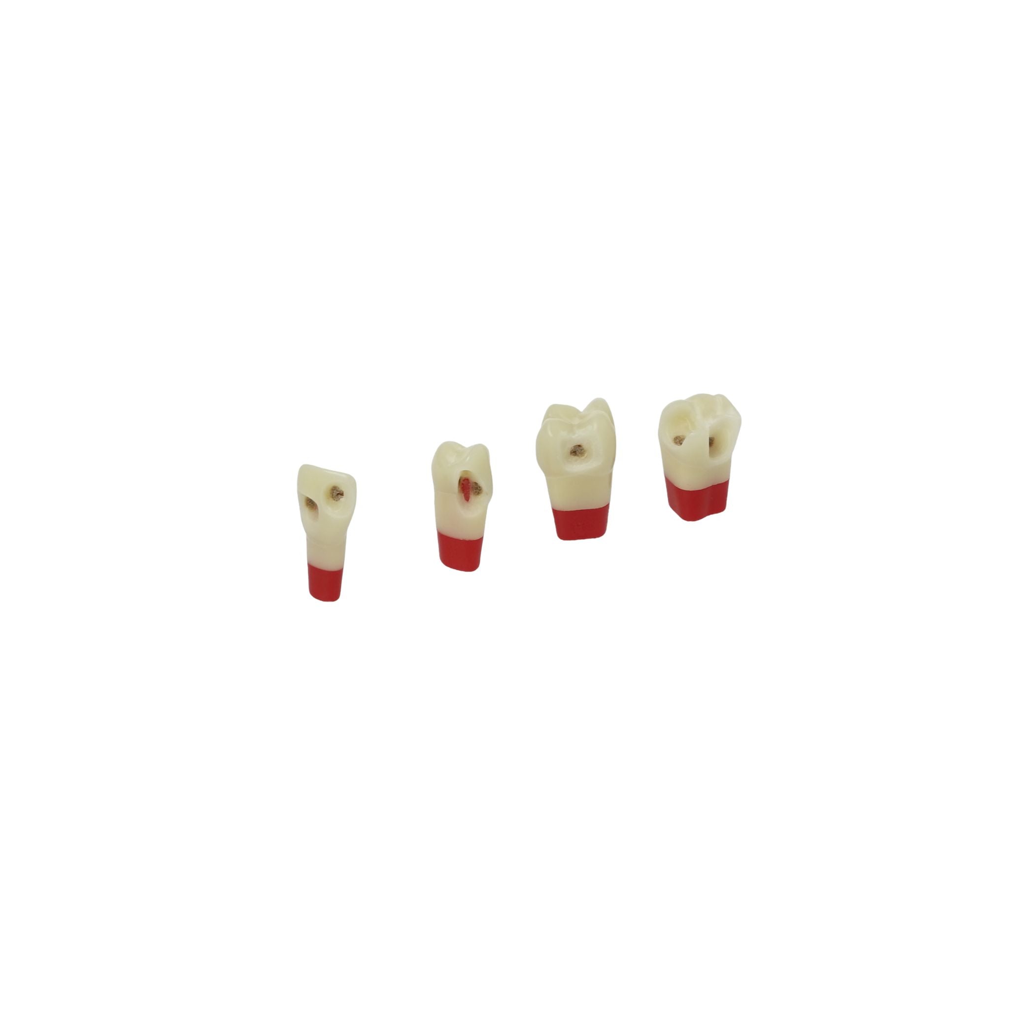 Dreischicht-Zähne mit Karies <br> ZSDPK 304 V1
