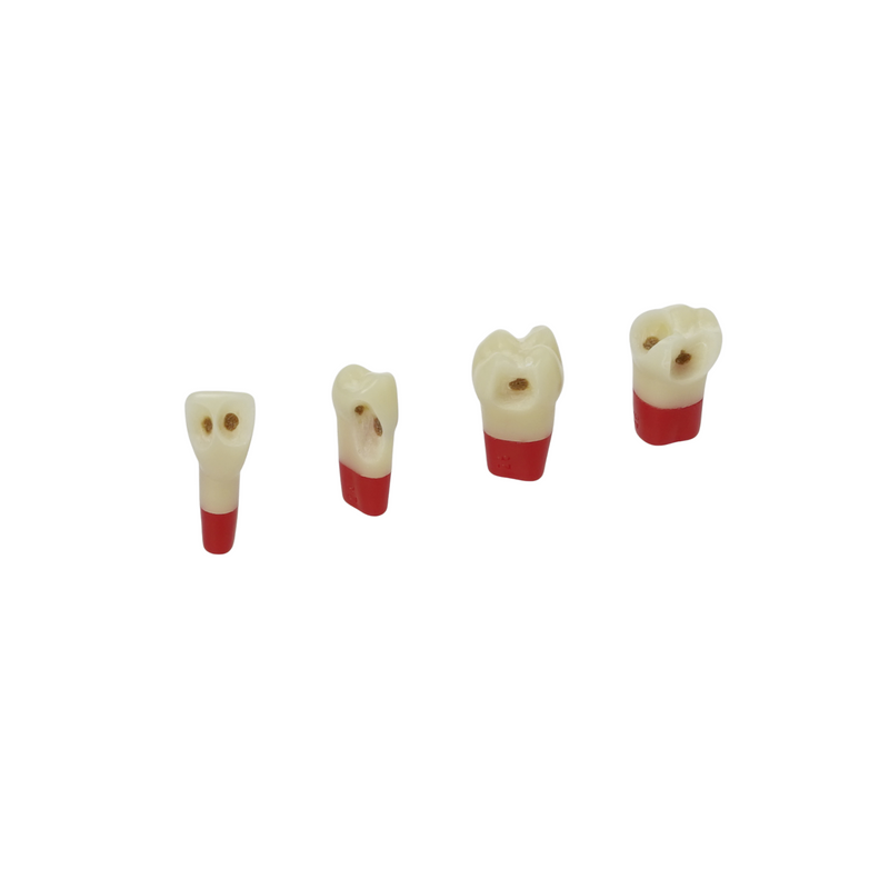 Dreischicht-Zähne mit Karies <br> ZSDPK 301 V1
