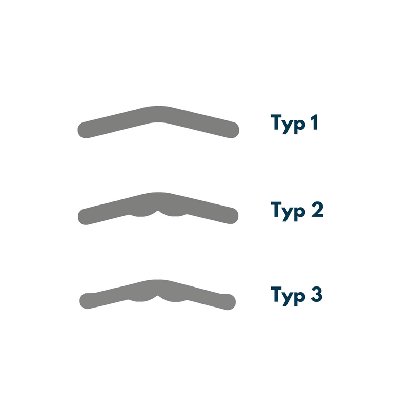 Tofflemire matrices