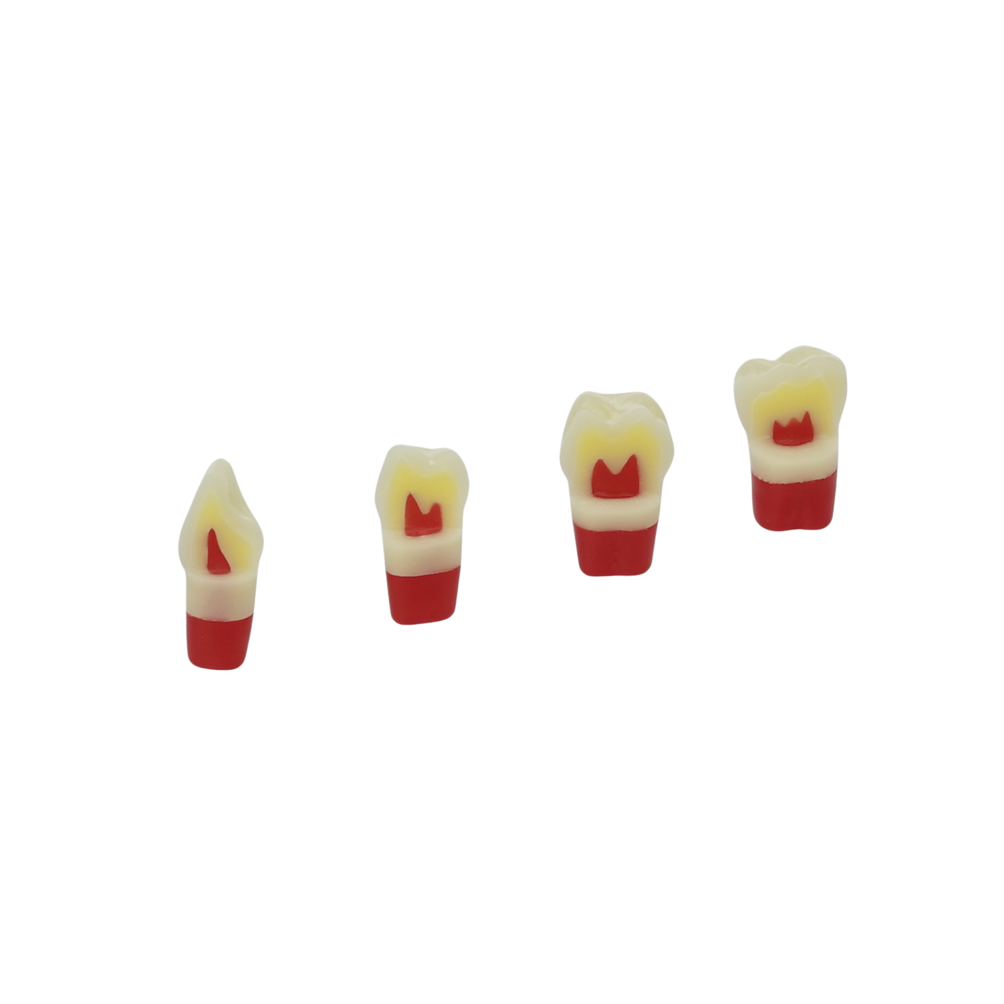 Dreischicht-Zähne ohne Karies <br> ZSDP 300