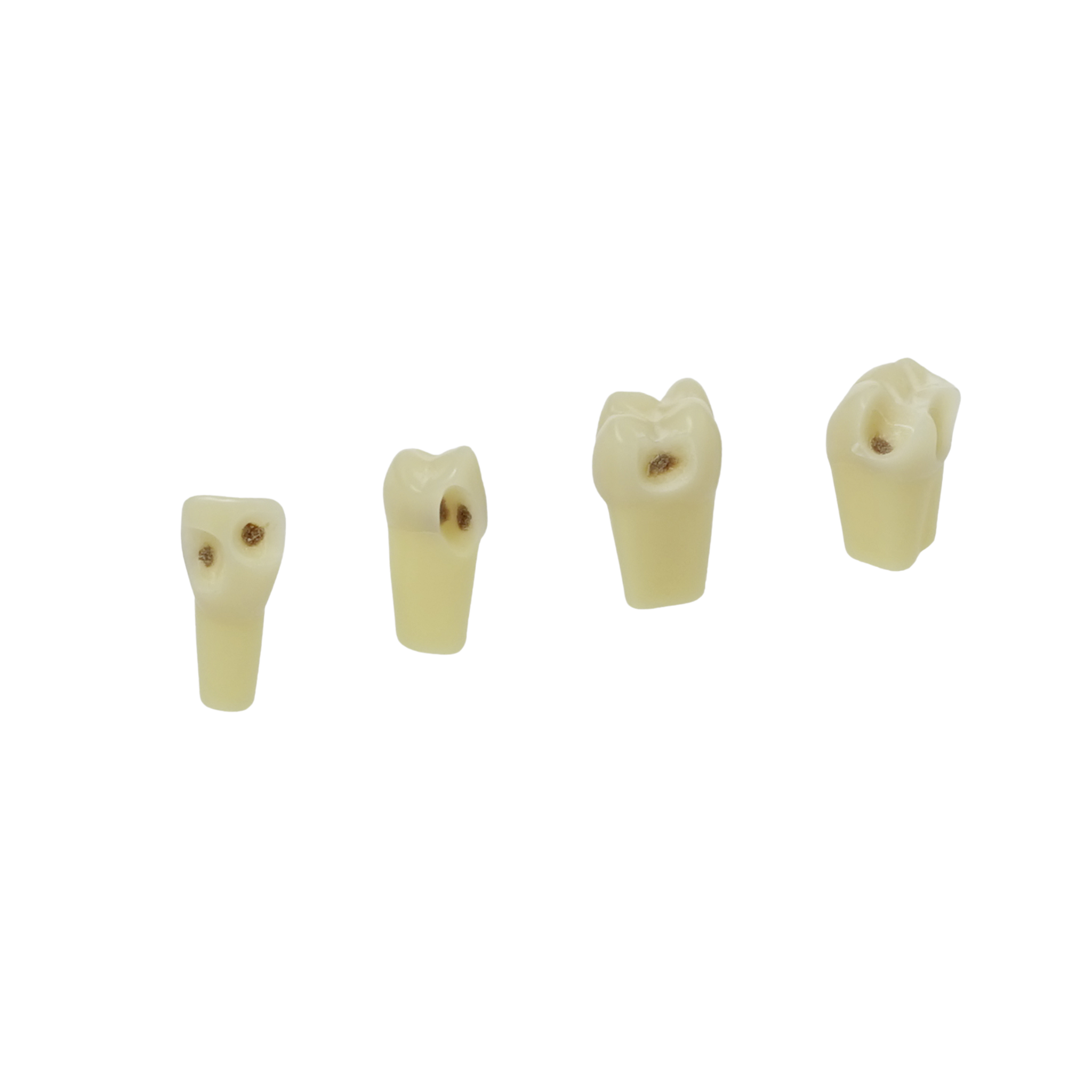 Two-layer teeth with caries<br> ZSDK 300 V1 | Frasaco