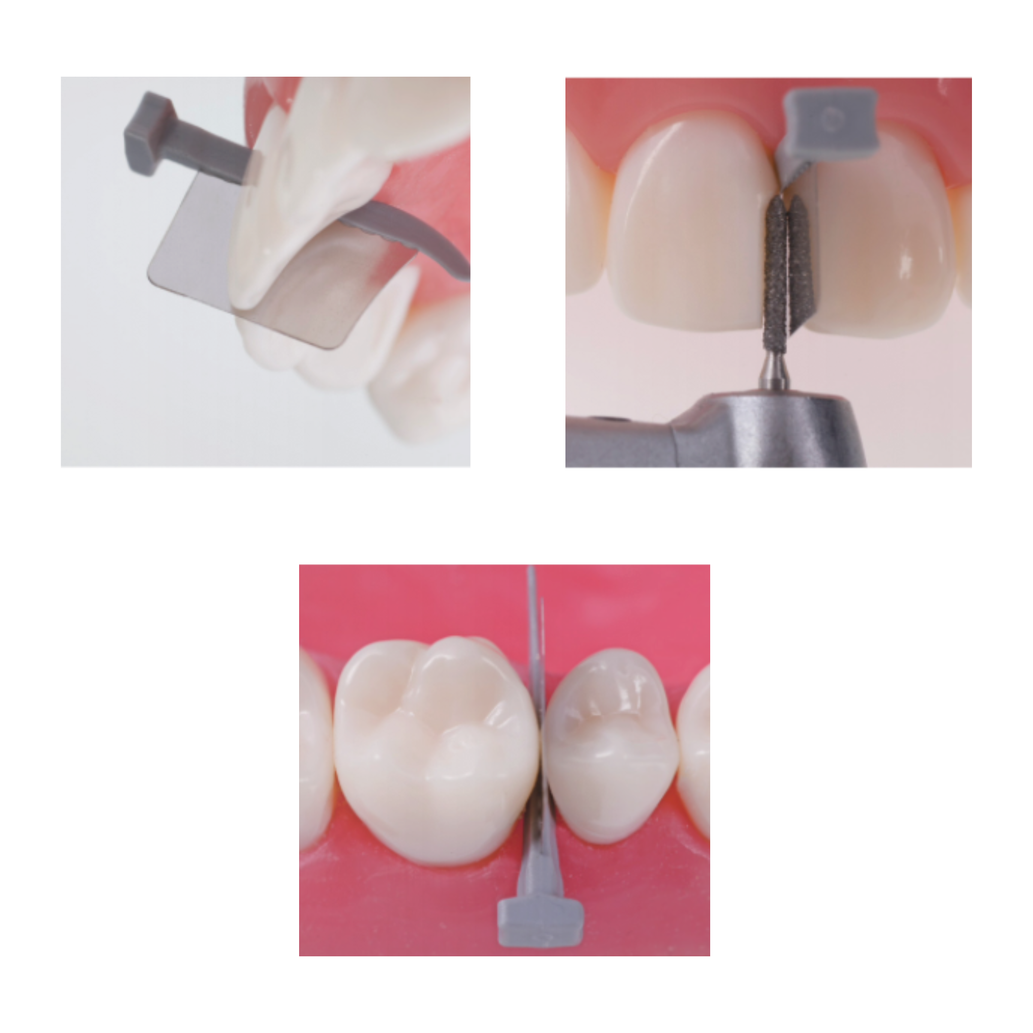 Interdental wedges<br> FenderWedge Prep