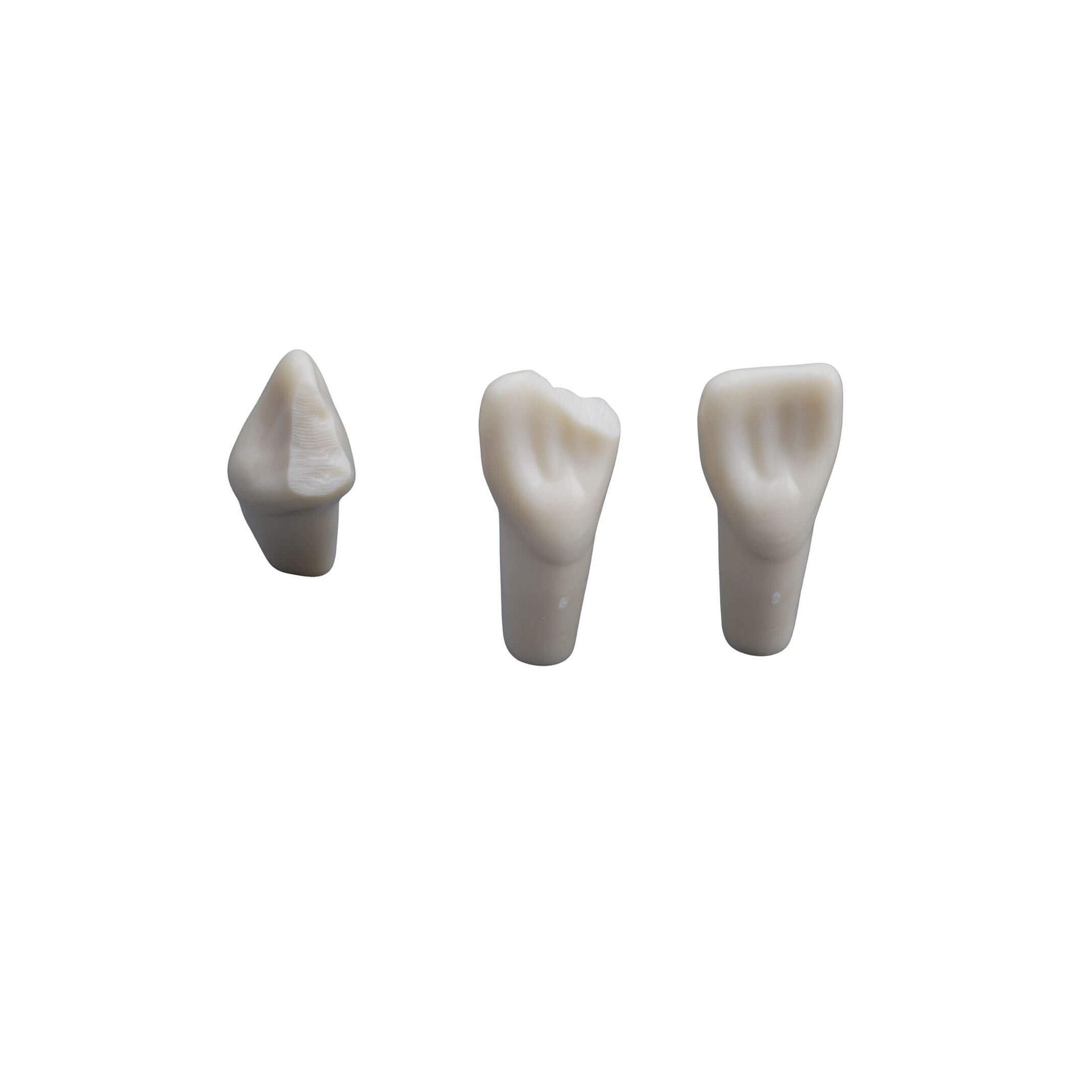 Sonderzahn <br> ANA-4 ZP11 99-013