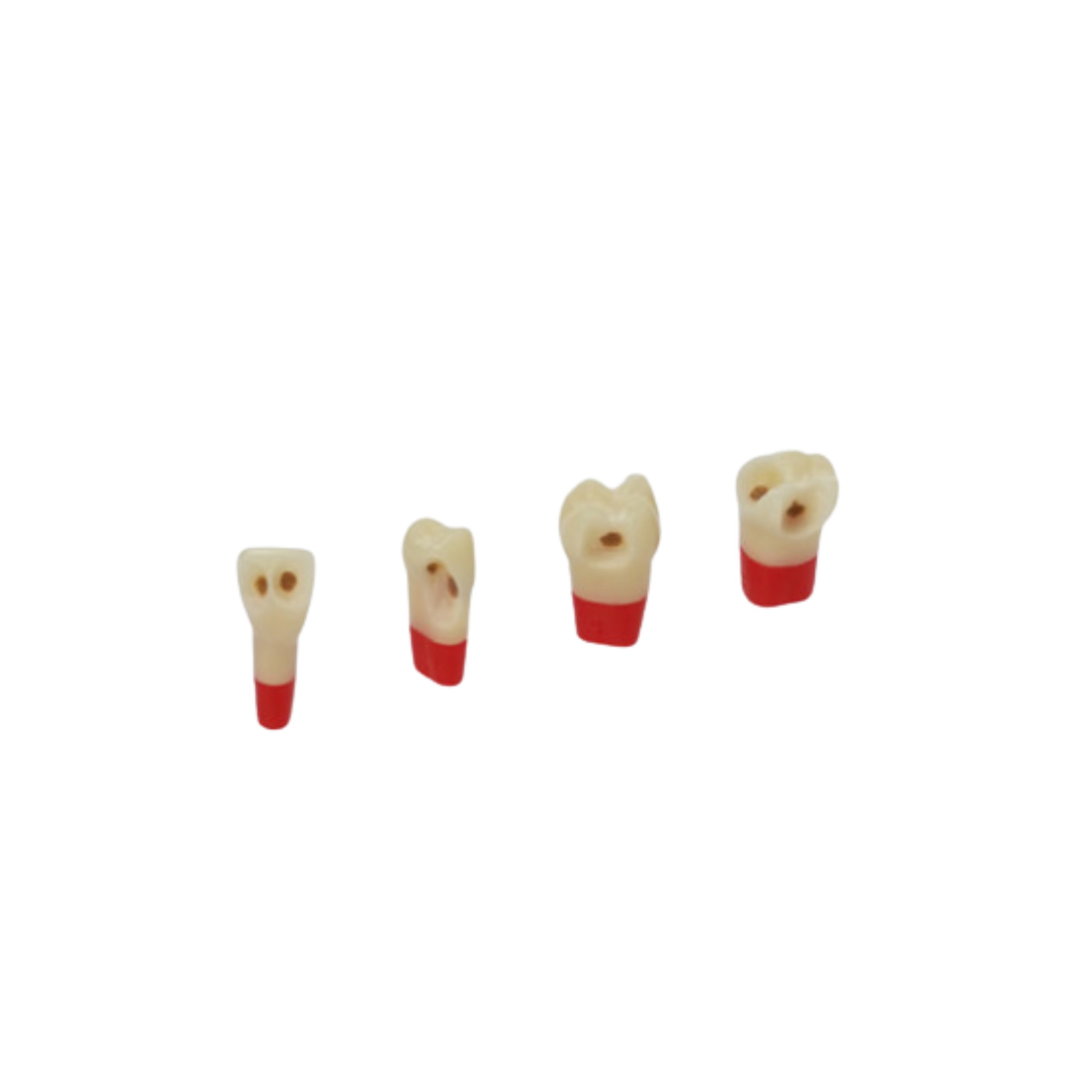 Three-layer teeth with caries<br> ZSDPKN